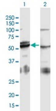 Anti-ATP5B antibody produced in mouse purified immunoglobulin, buffered aqueous solution
