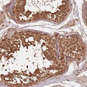 Anti-UBE3A antibody produced in rabbit Prestige Antibodies&#174; Powered by Atlas Antibodies, affinity isolated antibody, buffered aqueous glycerol solution