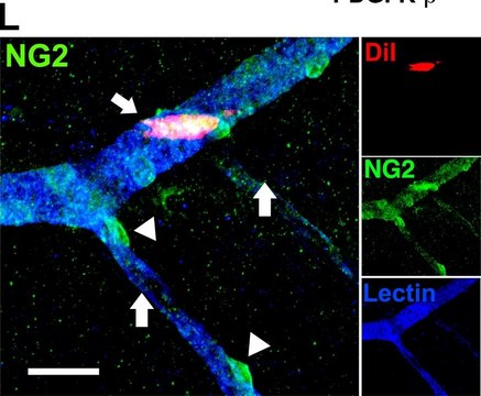 Anti-NG2 Chondroitin Sulfate Proteoglycan Antibody Chemicon&#174;, from rabbit