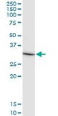 Monoclonal Anti-IL1B antibody produced in mouse clone 2A8, purified immunoglobulin, buffered aqueous solution