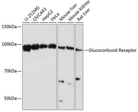 Anti-Glucocorticoid Receptor Antibody, clone 2K3E8, Rabbit Monoclonal