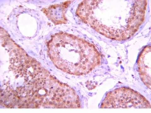 Anti-PP5 Antibody Upstate&#174;, from rabbit