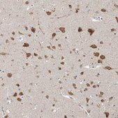 Anti-ZMYM2 antibody produced in rabbit Prestige Antibodies&#174; Powered by Atlas Antibodies, affinity isolated antibody, buffered aqueous glycerol solution