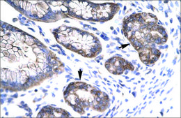 Anti-MEOX1 antibody produced in rabbit affinity isolated antibody