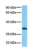 Anti-ADAMTS4 affinity isolated antibody