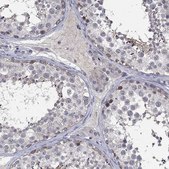 Anti-DDX3Y antibody produced in rabbit Prestige Antibodies&#174; Powered by Atlas Antibodies, affinity isolated antibody, buffered aqueous glycerol solution