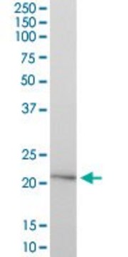 Anti-HYAL1 antibody produced in mouse purified immunoglobulin, buffered aqueous solution