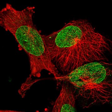 Anti-EPGN antibody produced in rabbit Prestige Antibodies&#174; Powered by Atlas Antibodies, affinity isolated antibody