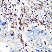 Anti-FSP1/S100A4 antibody produced in rabbit