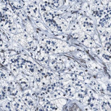 Anti-PBRM1 antibody produced in rabbit Prestige Antibodies&#174; Powered by Atlas Antibodies, affinity isolated antibody, buffered aqueous glycerol solution