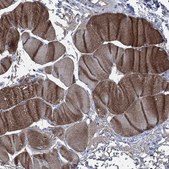Anti-OBSCN antibody produced in rabbit Prestige Antibodies&#174; Powered by Atlas Antibodies, affinity isolated antibody, buffered aqueous glycerol solution