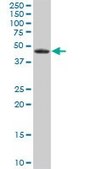 Anti-EPHX1 antibody produced in mouse purified immunoglobulin, buffered aqueous solution