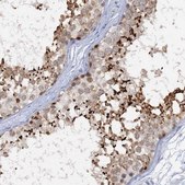 Anti-ACRBP antibody produced in rabbit Prestige Antibodies&#174; Powered by Atlas Antibodies, affinity isolated antibody, buffered aqueous glycerol solution