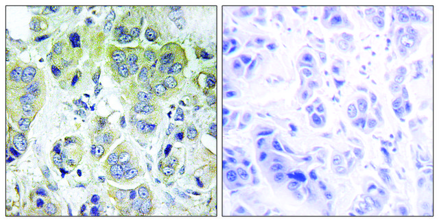 Anti-p70 S6 Kinase antibody produced in rabbit affinity isolated antibody
