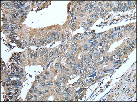 Anti-SMC5 affinity isolated antibody