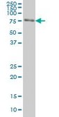 Monoclonal Anti-FKBP10 antibody produced in mouse clone 1C6, purified immunoglobulin, buffered aqueous solution