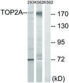 Anti-TOP2A, antibody produced in rabbit affinity isolated antibody