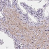 Anti-SETX antibody produced in rabbit Prestige Antibodies&#174; Powered by Atlas Antibodies, affinity isolated antibody, buffered aqueous glycerol solution
