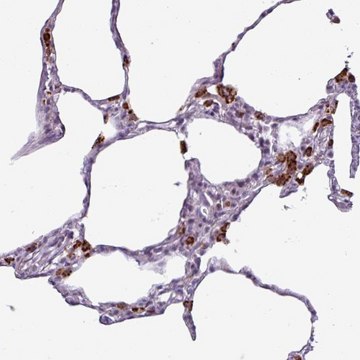 Anti-AMIGO2 antibody produced in rabbit Prestige Antibodies&#174; Powered by Atlas Antibodies, affinity isolated antibody, buffered aqueous glycerol solution