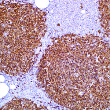 CD79a (SP18) Rabbit Monoclonal Antibody