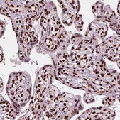 Anti-BRD4 antibody produced in rabbit Prestige Antibodies&#174; Powered by Atlas Antibodies, affinity isolated antibody, buffered aqueous glycerol solution
