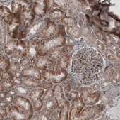 Anti-KANK4 antibody produced in rabbit Prestige Antibodies&#174; Powered by Atlas Antibodies, affinity isolated antibody, buffered aqueous glycerol solution