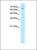 Anti-TSHR affinity isolated antibody