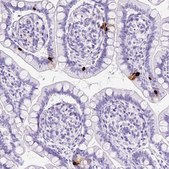 Anti-NTS antibody produced in rabbit Prestige Antibodies&#174; Powered by Atlas Antibodies, affinity isolated antibody, buffered aqueous glycerol solution