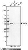 Anti-XRCC4 antibody produced in rabbit Prestige Antibodies&#174; Powered by Atlas Antibodies, affinity isolated antibody, buffered aqueous glycerol solution