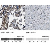 Anti-FBN1 antibody produced in rabbit Prestige Antibodies&#174; Powered by Atlas Antibodies, affinity isolated antibody, buffered aqueous glycerol solution