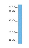 Anti-IDH2 antibody produced in rabbit affinity isolated antibody