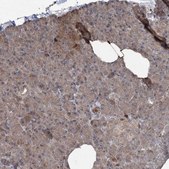 Anti-MAPK8IP2 antibody produced in rabbit Prestige Antibodies&#174; Powered by Atlas Antibodies, affinity isolated antibody, buffered aqueous glycerol solution
