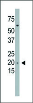 Anti-PMVK (C-term L177) antibody produced in rabbit IgG fraction of antiserum, buffered aqueous solution