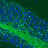 Monoclonal Anti-MOG antibody produced in mouse Prestige Antibodies&#174; Powered by Atlas Antibodies, clone CL2852, purified immunoglobulin, buffered aqueous glycerol solution
