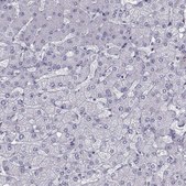Anti-QPCT antibody produced in rabbit Prestige Antibodies&#174; Powered by Atlas Antibodies, affinity isolated antibody, buffered aqueous glycerol solution
