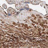 Anti-P4HA1 antibody produced in rabbit Prestige Antibodies&#174; Powered by Atlas Antibodies, affinity isolated antibody, buffered aqueous glycerol solution