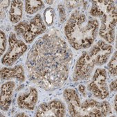 Anti-LAMP1 antibody produced in rabbit Prestige Antibodies&#174; Powered by Atlas Antibodies, affinity isolated antibody, buffered aqueous glycerol solution