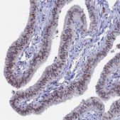 Anti-BRD2 antibody produced in rabbit Prestige Antibodies&#174; Powered by Atlas Antibodies, affinity isolated antibody, buffered aqueous glycerol solution