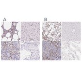 Anti-PADI4 antibody produced in rabbit Prestige Antibodies&#174; Powered by Atlas Antibodies, affinity isolated antibody, buffered aqueous glycerol solution
