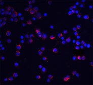 Anti-IL-1RACP (ab1) antibody produced in rabbit affinity isolated antibody, buffered aqueous solution