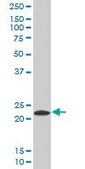 Anti-PYCARD, (N-terminal) antibody produced in mouse purified immunoglobulin, buffered aqueous solution