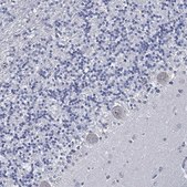 Anti-USP29 antibody produced in rabbit Prestige Antibodies&#174; Powered by Atlas Antibodies, affinity isolated antibody, buffered aqueous glycerol solution
