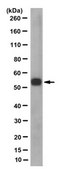 Anti-Retinal Dehydrogenase 1/ALDH1A1 Antibody, clone 8D7.1 clone 8D7.1, from mouse