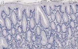 Anti-MUC5AC Antibody, clone CLH2 ZooMAb&#174; Mouse Monoclonal recombinant, expressed in HEK 293 cells
