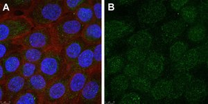 Anti-Interferon &#945;-2 Antibody, clone 1E13 ZooMAb&#174; Rabbit Monoclonal recombinant, expressed in HEK 293 cells