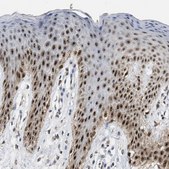 Anti-ELAC2 antibody produced in rabbit Prestige Antibodies&#174; Powered by Atlas Antibodies, affinity isolated antibody, buffered aqueous glycerol solution