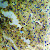 Anti-phospho-VEGFR2 (pTyr1175) antibody produced in rabbit affinity isolated antibody