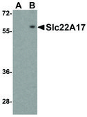 Anti-Slc22A17 antibody produced in rabbit affinity isolated antibody, buffered aqueous solution