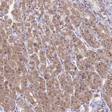 Anti-EXOC6B antibody produced in rabbit Prestige Antibodies&#174; Powered by Atlas Antibodies, affinity isolated antibody, buffered aqueous glycerol solution