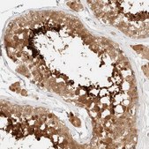 Anti-PCYT2 antibody produced in rabbit Prestige Antibodies&#174; Powered by Atlas Antibodies, affinity isolated antibody, buffered aqueous glycerol solution, Ab2